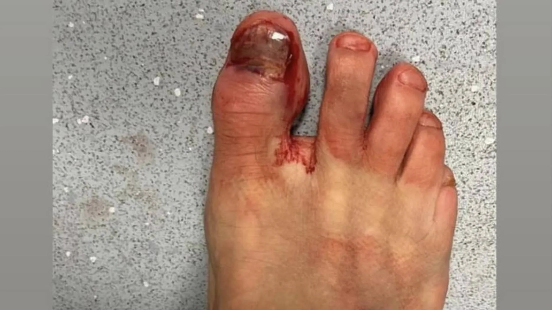 Alluce-Felipe-Anderson